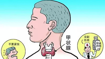 甲狀腺長結(jié)節(jié) 難道離癌不遠了？！