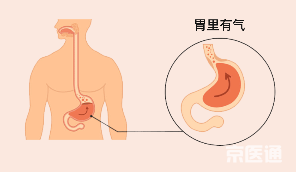 宣醫(yī)科普|突然打嗝又止不??？醫(yī)生給出了3種科學(xué)方法！