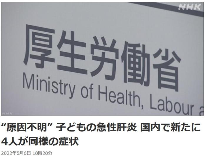 日本新增4例不明原因兒童急性肝炎病例