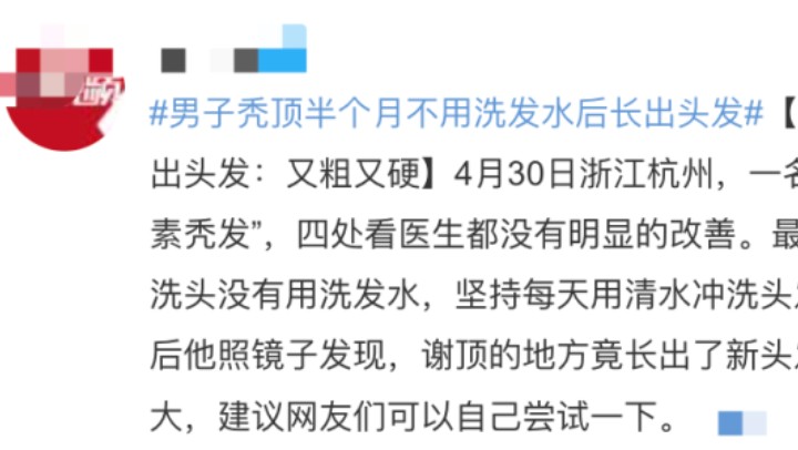 每天洗頭會(huì)加重脫發(fā)嗎？