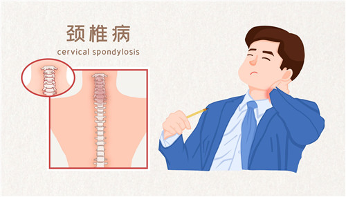 網(wǎng)傳頸椎病“自救指南”靠譜嗎？專家解讀來(lái)了
