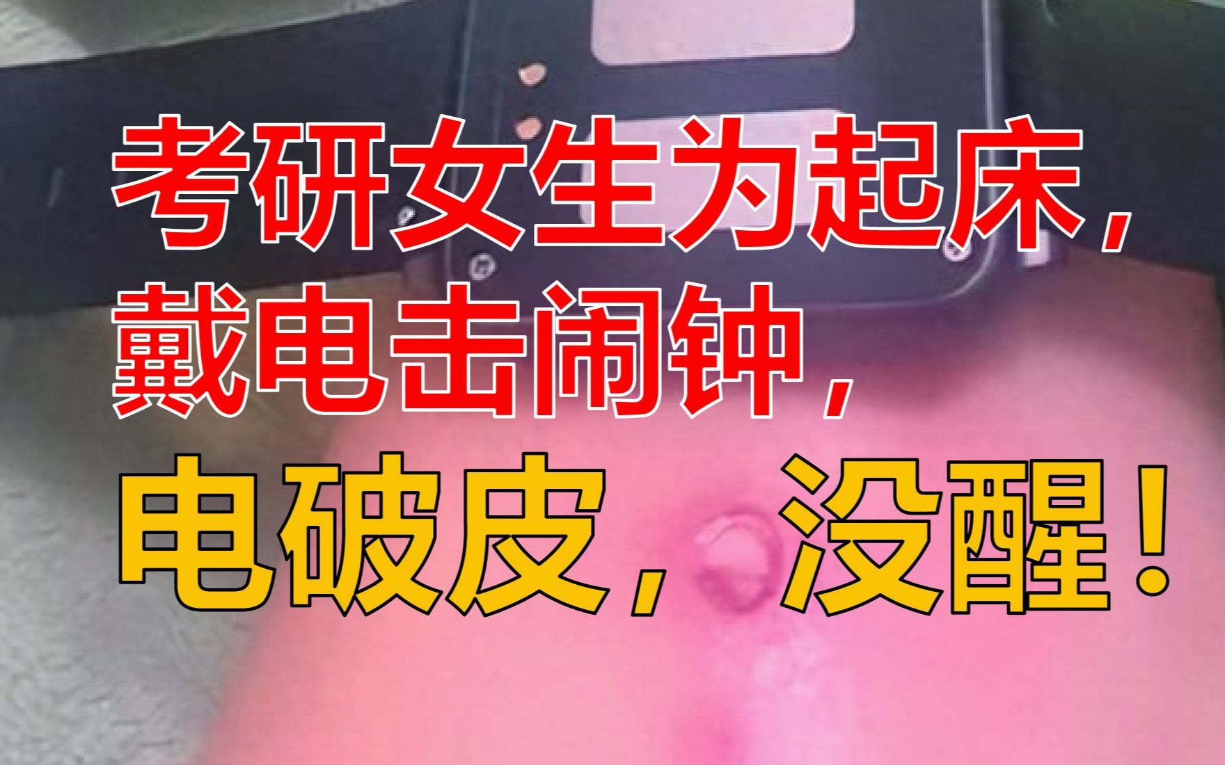 電擊鬧鐘需謹慎使用 或造成局部電燒傷