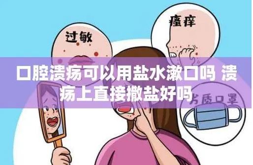口腔潰瘍 撒鹽喝酒消毒有用嗎？