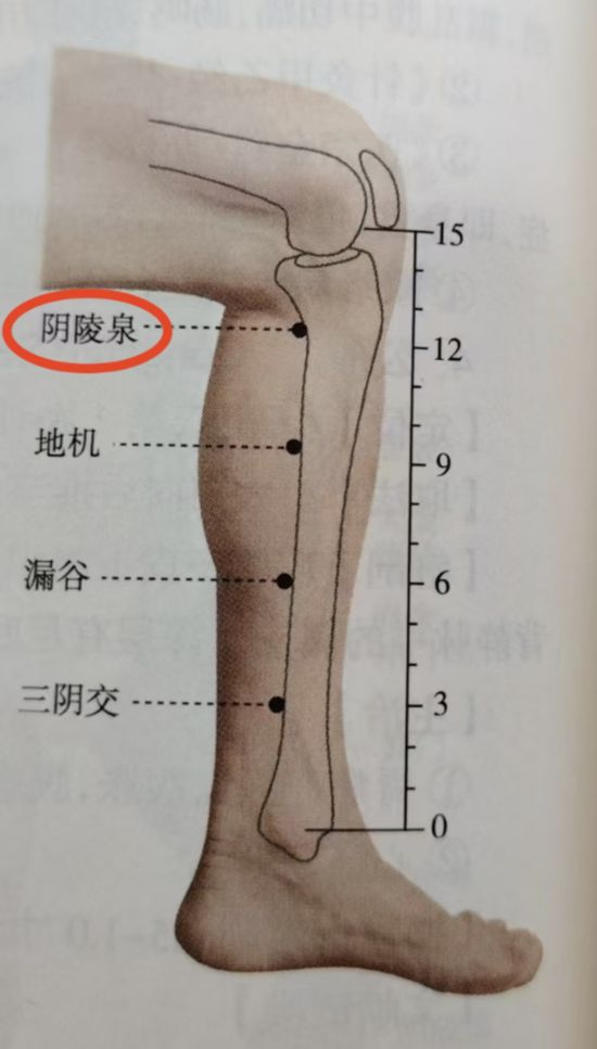 圖中標(biāo)紅為陰陵泉穴。（受訪者供圖）